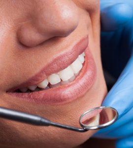 Importance of Preventive Care - Pourquoi les soins dentaires préventifs sont importants - centre dentaire dre nathalie kadoch